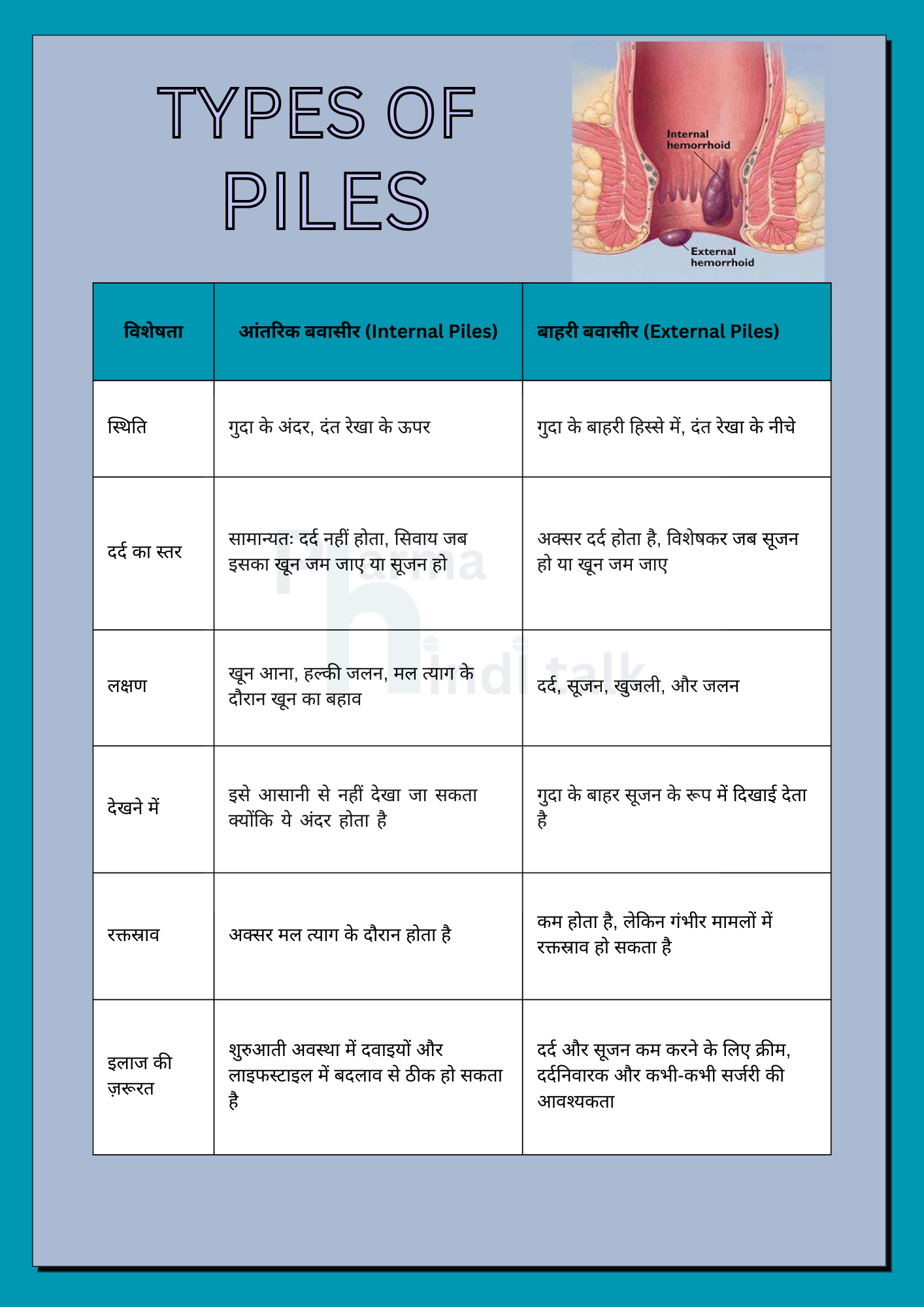 comparison table of types of piles