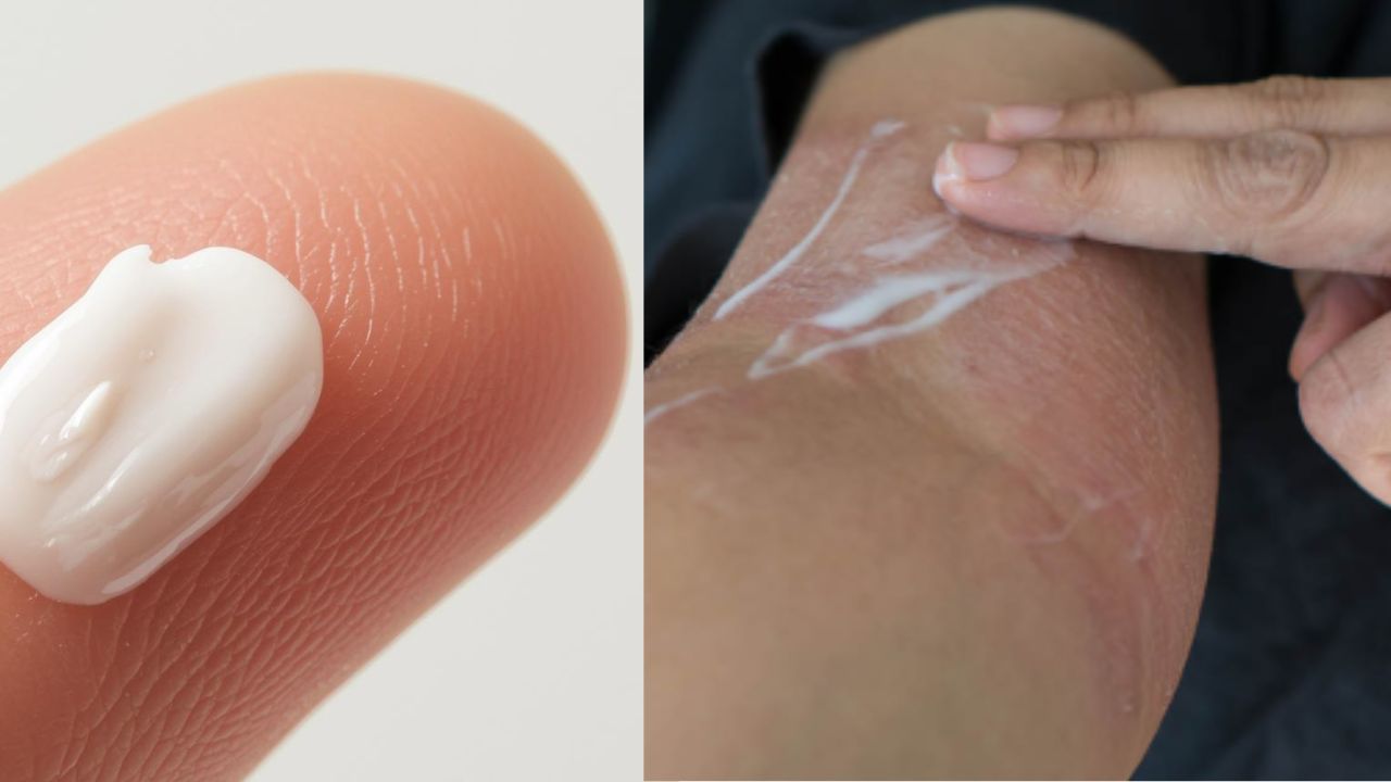 Fucibet cream लगाने का सही तरीका 