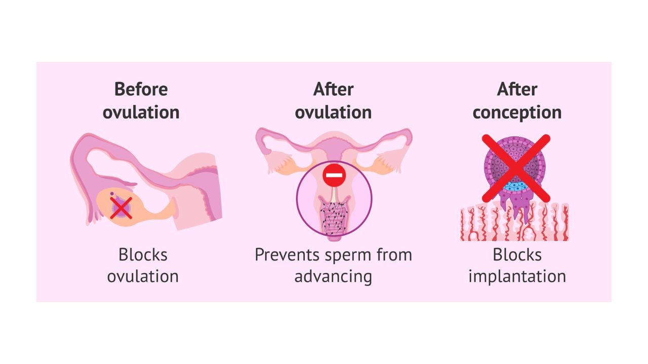 Unwanted 72 kaise kaam karti hai ovulation diagram