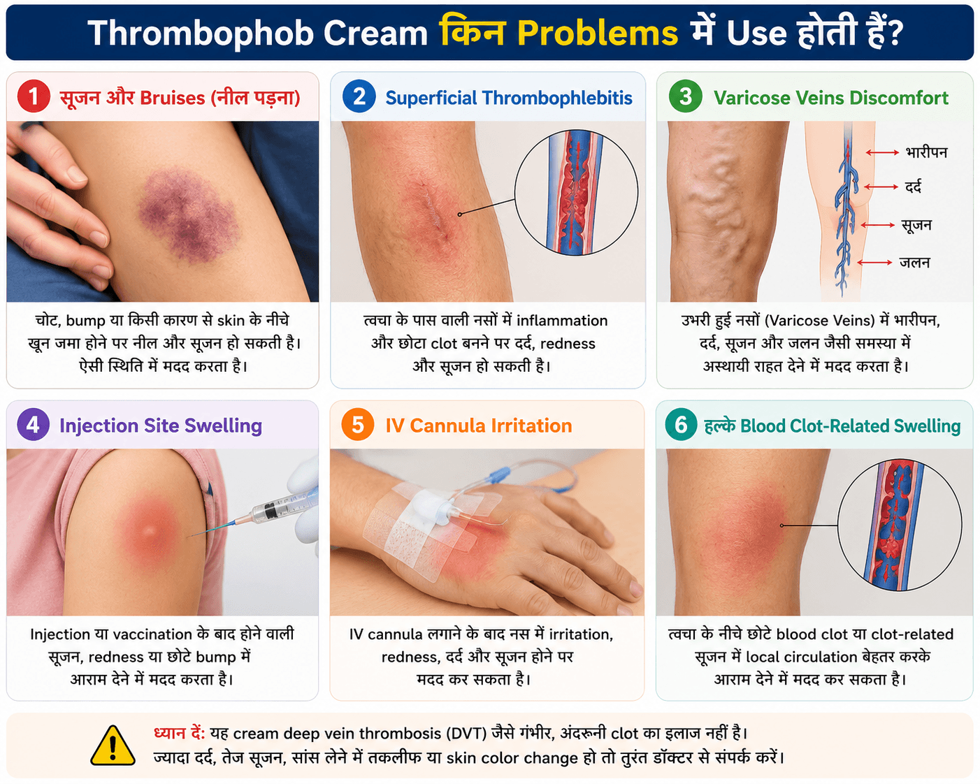 Thrombophob Cream किन problems में use होती है?